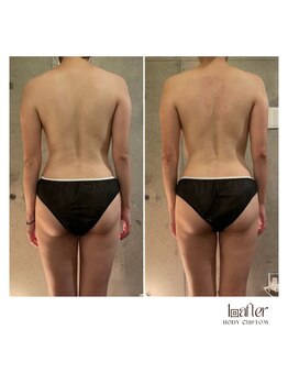 サプナジー(Suppnrgy)/カスタムトリートメント