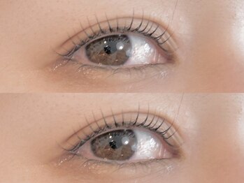 ティーツリー(tea tree)/