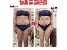 最短で痩せたい人はセルラジがオススメ
