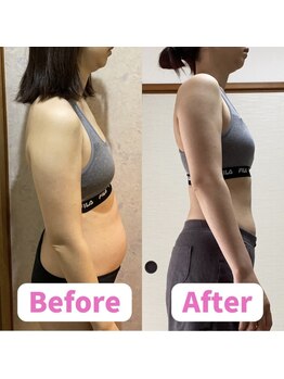 ボディキュア ブライダル美容整体 大阪梅田/【痩身×整体】4ヶ月でー5kg！