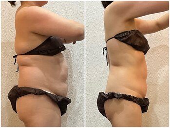 美容整体ウェリナ 名駅院/小顔矯正/骨盤矯正/美脚サロン