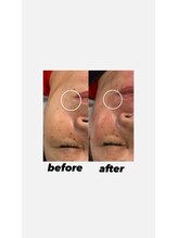 ウネ 吉祥寺(une)/