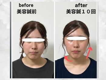 サロンスマイル