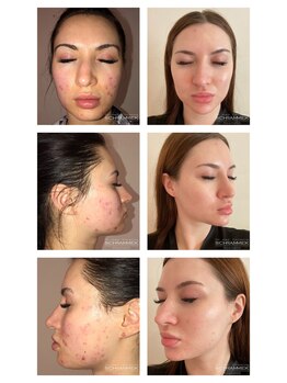 オリエンタルグリーン 銀座(ORIENTAL GREEN)/グリーンピール