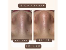 ユジュ(yju)の雰囲気(小鼻の黒ずみ、顔全体の毛穴汚れも徹底除去☆小顔やエイジングも)