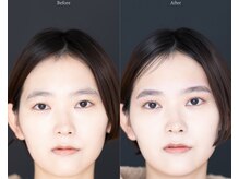 ルフトエーデ(LUFT Ode)の雰囲気（トータルバランスで整えるEYE/BROWセットメニュー◎）