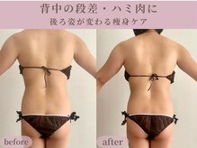 ティターニア(Titania)の雰囲気（背中の段差/ハミ肉/自分では見えない背中こそしっかり集中ケア☆）