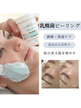 ビボーラ(BEBEAURA)の写真/施術後１回でも効果◎！乳酸菌ピーリングでハリ・ツヤ・保湿・美白ケア☆理想の肌土台へ導き、輝く素肌へ♪