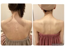 ボーテ(beaute)の雰囲気(ブライダルエステ歴20年・ドレスから見える面はとにかく美しく♪)