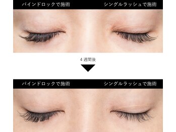 リュクス(Luxe+TKM HANATEN)/バインドロック