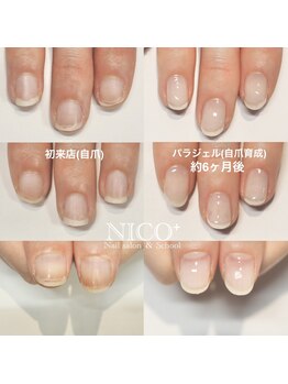 ニコプラス(NICO+)/自爪育成中