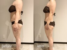 エステティック ミュー(Esthetic MiEUX)/全身痩せコース4回の変化