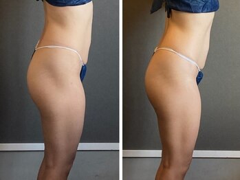 リジュ(Reju)/ハイパーナイフEX＋シェイプ効果