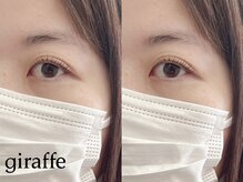 ジラフ(giraffe)/【ラッシュリフト】立ち上げ