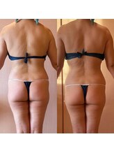 凪 横浜/スリムアトラクション１回