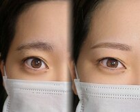 ルルプラス(Lulu+)