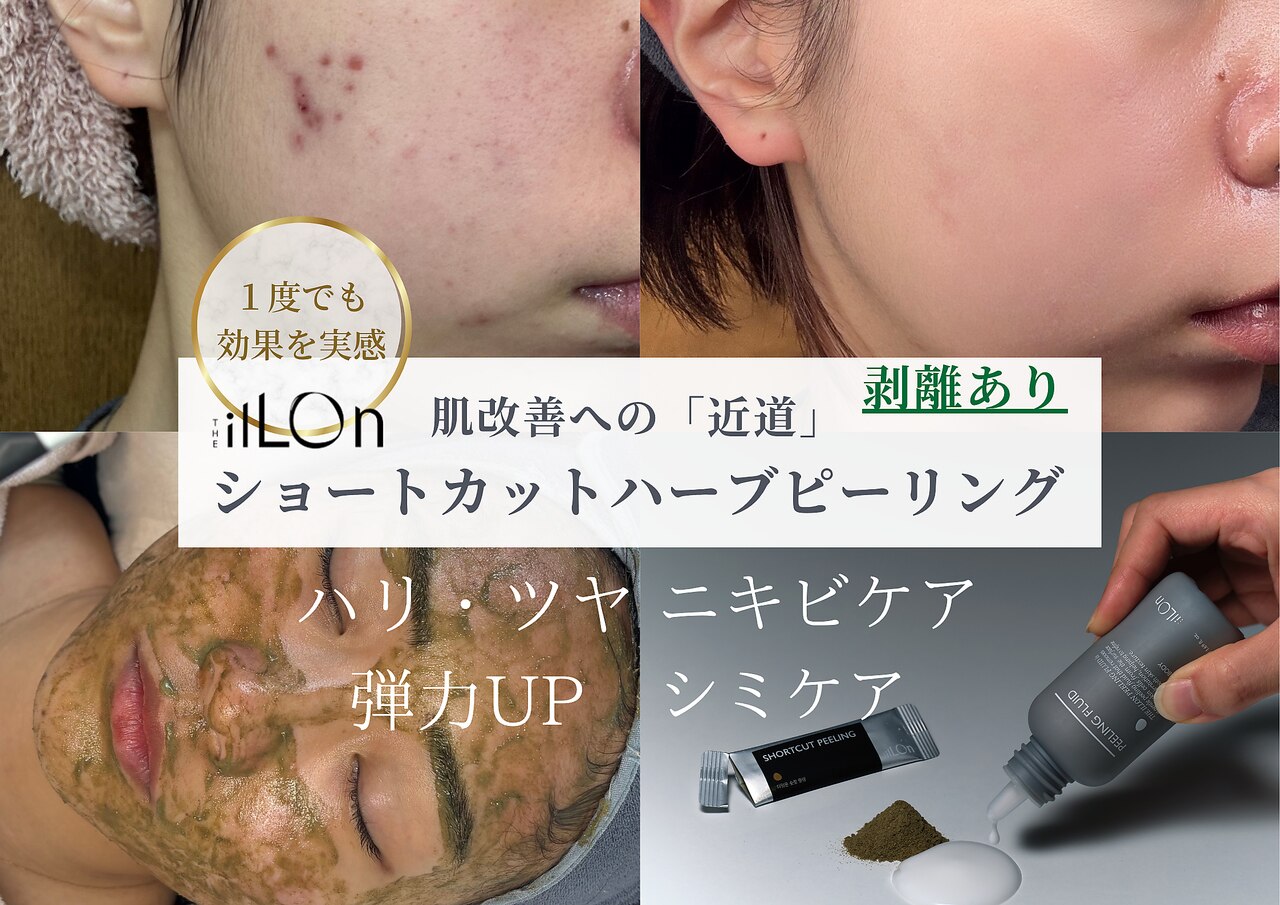 アンナビューティ 六本木 乃木坂店(Anna Beauty)｜ホットペッパー