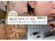 アンナビューティ 六本木 乃木坂店(Anna Beauty)