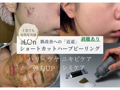 アンナビューティ 六本木 乃木坂店(Anna Beauty)の写真