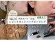 アンナビューティ 六本木 乃木坂店(Anna Beauty)の写真