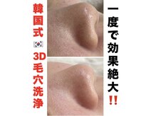 ネイルサロン きらら 平塚店の雰囲気(SNSで話題☆いちご鼻・黒ずみ・ザラツキなどの毛穴悩みに効果的!)