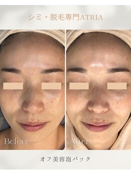 アトリア(ATRIA)/ピュールボーテ &nbsp;オフ美容set