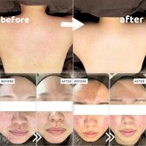 ハルミハーブピーリング 池袋店(Harumi Herb Peeling)