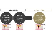ブレスユー 北堀江(bless you)/men's脱毛・ever since