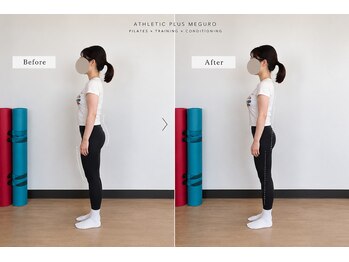 アスレチックプラス 目黒/BeforeAfter 反り腰・前もも改善