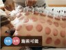 【カッピング】巡りの良い身体へ♪¥2500