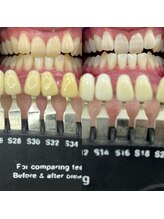 トウキョースワーズ 渋谷店(TOKYO SWRS)/#ホワイトニング #渋谷 #池袋