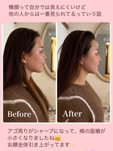 ピオニー(Peony)/Before & After