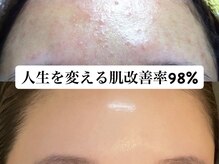 プリマジュール