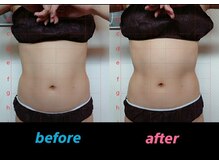 キララ 日立店(Kirara)/ダイエット効果◎