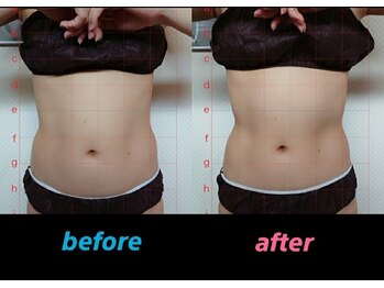 キララ 日立店(Kirara)/ダイエット効果◎