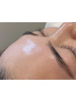 顔脱毛がしたい