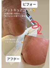リゼラアンドコー 盛岡店/ドイツ式フットケア専門店