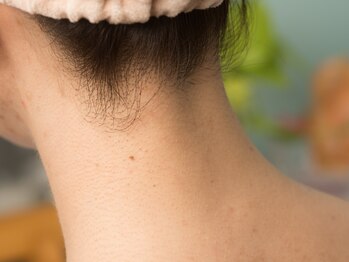 ココネローズ 刈谷サロン/脱毛