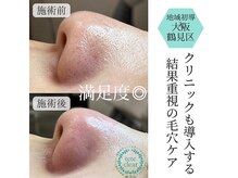 リッカロッカ(RIKKA&ROCCA)/衝撃と感動のBefore・After