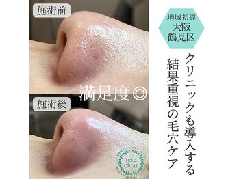 リッカロッカ(RIKKA&ROCCA)/衝撃と感動のBefore・After