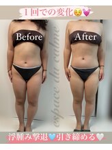 カルマーアンドビー(Calmer & Be.)/【レディース痩身】Before/After