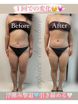 カルマーアンドビー(Calmer & Be.)/【レディース痩身】Before/After