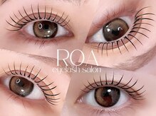 ロア(Roa)