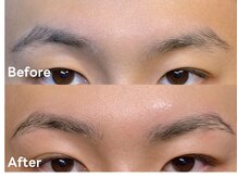 アルカナ(ARCANA)/HBL（ハリウッドブロウリフト）