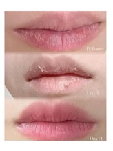 澄葉 新宿(sumiha)/ローマピンク/唇