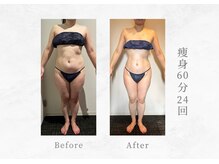 エヴァーグレース 三河安城店(EVER GRACE)/【ボディー管理】痩身60