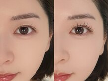 タム(TAM)/〈本町〉LED120本