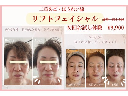 ラプタス(Rapu+)の写真