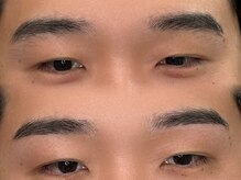 ノエ アイ(Noe.)/生え癖でお悩みの方も