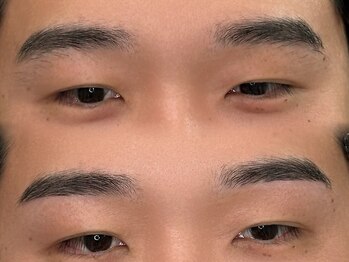ノエ アイ(Noe.)/生え癖でお悩みの方も